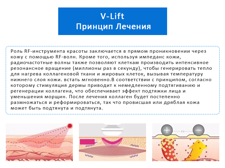 V-LIFT RF Антивозрастная Подтяжка И Подтяжка Кожи И Удаление Морщин